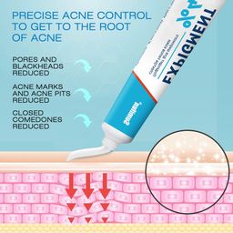 Sumifun Acne Cream – Deep Acne Control, Fade Acne Marks, Minimize Pores