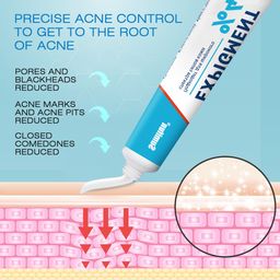 Sumifun Acne Cream – Deep Acne Control, Fade Acne Marks, Minimize Pores