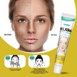 Sumifun Melasma Relief Cream – Dark Spot Remover, Whitening & Brightening, 100% Natural