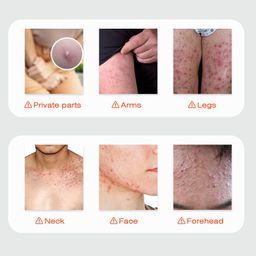 Sumifun Hair Follicle Soothing Ointment – Relieves Itching & Hair Follicle Discomfort