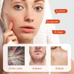 Sumifun Hair Follicle Soothing Ointment – Relieves Itching & Hair Follicle Discomfort