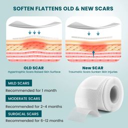 Sumifun Silicone Scar Tape – Advanced Scar Removal & Skin Repair