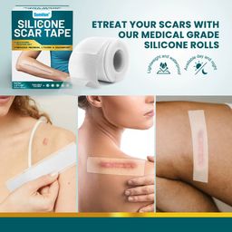 Sumifun Silicone Scar Tape – Advanced Scar Removal & Skin Repair