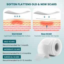 Sumifun Silicone Scar Tape – Advanced Scar Removal & Skin Repair