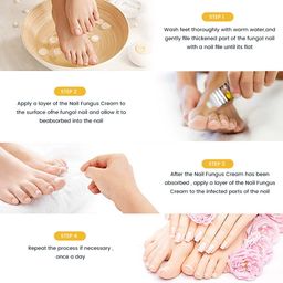 Sumifun NewBee Venom Fungal Nail Cream – Extra Strong Formula