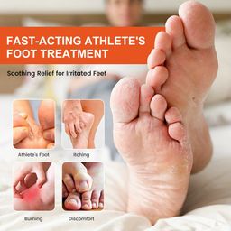 Sumifun Athlete’s Foot Cream – Powerful Anti-Fungal Treatment, Relieves Itching & Odor, Soothes Cracked Skin (20g x 2)