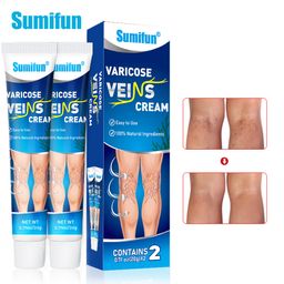Sumifun Varicose Veins Cream – Natural Relief for Swollen Veins, Pain & Itching, Supports Circulation (20g x 2)