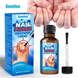 Sumifun Varicose Veins Cream – Natural Relief for Swollen Veins, Pain & Itching, Supports Circulation (20g x 2)