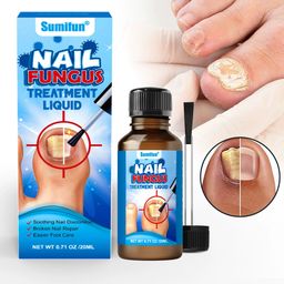 Sumifun Varicose Veins Cream – Natural Relief for Swollen Veins, Pain & Itching, Supports Circulation (20g x 2)