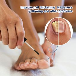 Sumifun Varicose Veins Cream – Natural Relief for Swollen Veins, Pain & Itching, Supports Circulation (20g x 2)