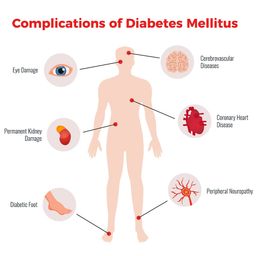 Sumifun Diabetic Foot Cream | Ulcer Repair, Circulation Boost, Dry & Itch Relief