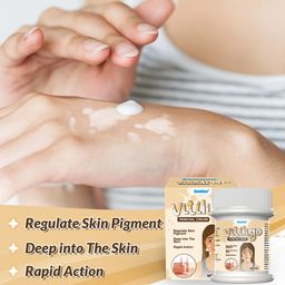 Sumifun Vitiligo Removal Cream | Natural Pigment Regeneration Formula