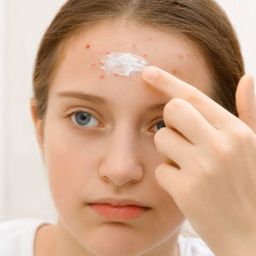 Sumifun Acne Care Cream with Tea Tree Oil