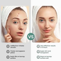 Sumifun Acne Care Cream with Tea Tree Oil