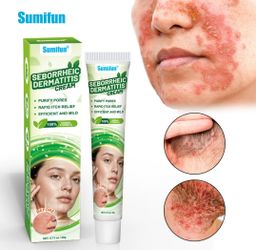 Sumifun Seborrheic Dermatitis Skin Care Cream, Anti-Allergy Redness & Itch Relief Soothing Cream