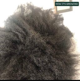 Hair growth and Antidandruff Combo