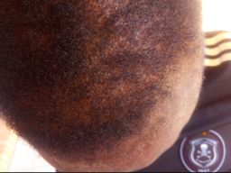 Botlē Hair Growth combo by SEFATE SA BOPHELO
