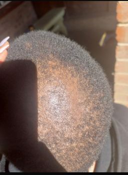 Botlē Hair Growth combo by SEFATE SA BOPHELO
