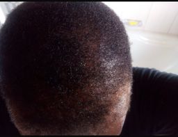 Botlē Hair Growth combo by SEFATE SA BOPHELO