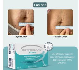 REPAIR pour la RÉGÉNÉRATION de la PEAU , MARQUES CUTANÉES 