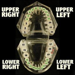 Real Solid 22K Gold Custom Grillz Teeth Grills