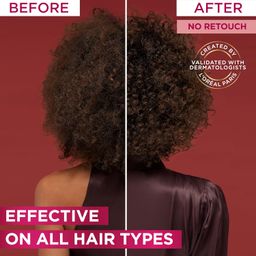 L’Oréal Paris Elvive Fall Resist Conditioner for Weak Hair and Hair Fall 360ML