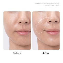 MEDICUBE Beauty device AGE R BOOSTER PRO EX PINK