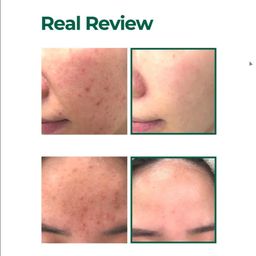 SOMEBYMI AHA.BHA.PHA 30 Days Miracle Starter Kit