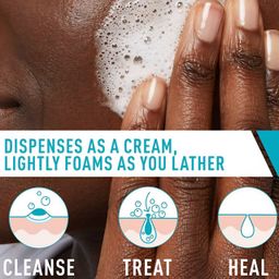 CeraVe - Acne Foaming Cream Cleanser, 4% Benzoyl Peroxide