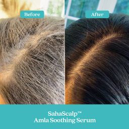 Fable & Mane Amla Soothing Serum 