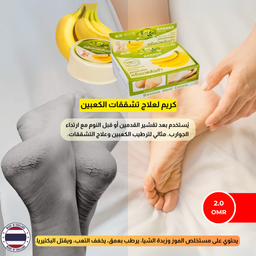 كريم الموز وزبدة الشيا للأقدام  |  Banana Heel Cream Chivaviti