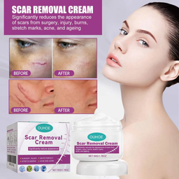 SCAR REMOVAL CREAM