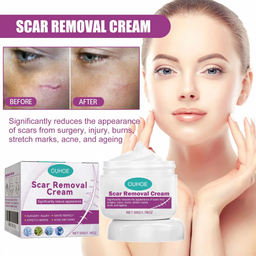 SCAR REMOVAL CREAM