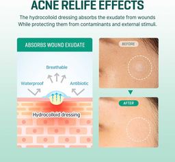 SOME BY MI Clear Spot Patch