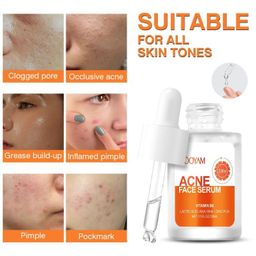 MOOYAM 30ml Facial Serum for Acne, Pimples, Blemishes & Oily Skin