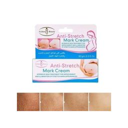 Aichun Beauty Anti-stretch Mark Cream, 60g