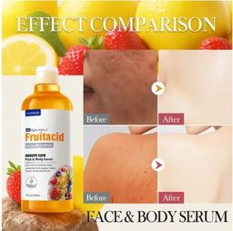 SADOER Fruit Acid Body Serum