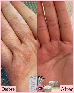 🇰🇷𝐌𝐀𝐃𝐄 𝐈𝐍 𝐊𝐎𝐑𝐄𝐀!🇰🇷 𝐄𝐋𝐋𝐔𝐑𝐄 𝟭𝟬-𝗜𝗡-𝟭 𝗥𝗘𝗗 𝗚𝗜𝗡𝗦𝗘𝗡𝗚 𝗦𝗞𝗜𝗡 𝗕𝗢𝗢𝗦𝗧𝗘𝗥 𝗝𝗘𝗟𝗟𝗬 | 𝐒𝐔𝐏-𝐈𝐓 𝐅𝐑𝐎𝐌 𝐊𝐎𝐑𝐄𝐀! SKIN SUPPLEMENT