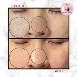 🔥𝐇𝐈𝐆𝐇𝐋𝐘 𝐑𝐀𝐕𝐄𝐃!!🔥 🍅𝐄𝐋𝐋𝐔𝐑𝐄 𝐓𝐎𝐌𝐀𝐓𝐎 𝐃𝐄𝐄𝐏 𝐂𝐋𝐄𝐀𝐍𝐒𝐈𝐍𝐆 𝐆𝐑𝐀𝐏𝐇𝐄𝐍𝐄 𝐁𝐔𝐁𝐁𝐋𝐄 𝐌𝐀𝐒𝐊🍅 - EXFOLIATING MASK