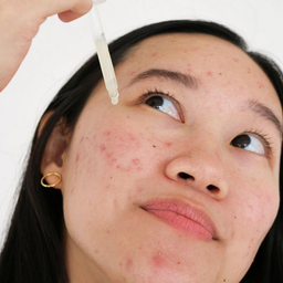 Cocokind Probiotic Acne Serum 30ml