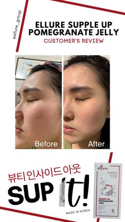 🇰🇷𝐌𝐀𝐃𝐄 𝐈𝐍 𝐊𝐎𝐑𝐄𝐀!🇰🇷 𝐄𝐋𝐋𝐔𝐑𝐄 𝟭𝟬-𝗜𝗡-𝟭 𝗥𝗘𝗗 𝗚𝗜𝗡𝗦𝗘𝗡𝗚 𝗦𝗞𝗜𝗡 𝗕𝗢𝗢𝗦𝗧𝗘𝗥 𝗝𝗘𝗟𝗟𝗬 | 𝐒𝐔𝐏-𝐈𝐓 𝐅𝐑𝐎𝐌 𝐊𝐎𝐑𝐄𝐀! SKIN SUPPLEMENT