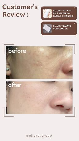 🔥𝐇𝐈𝐆𝐇𝐋𝐘 𝐑𝐀𝐕𝐄𝐃!!🔥 🍅𝐄𝐋𝐋𝐔𝐑𝐄 𝐓𝐎𝐌𝐀𝐓𝐎 𝐃𝐄𝐄𝐏 𝐂𝐋𝐄𝐀𝐍𝐒𝐈𝐍𝐆 𝐆𝐑𝐀𝐏𝐇𝐄𝐍𝐄 𝐁𝐔𝐁𝐁𝐋𝐄 𝐌𝐀𝐒𝐊🍅 - EXFOLIATING MASK