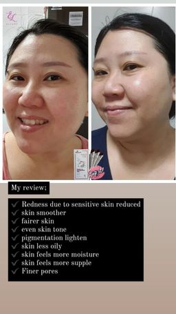 🇰🇷𝐌𝐀𝐃𝐄 𝐈𝐍 𝐊𝐎𝐑𝐄𝐀!🇰🇷 𝐄𝐋𝐋𝐔𝐑𝐄 𝟭𝟬-𝗜𝗡-𝟭 𝗥𝗘𝗗 𝗚𝗜𝗡𝗦𝗘𝗡𝗚 𝗦𝗞𝗜𝗡 𝗕𝗢𝗢𝗦𝗧𝗘𝗥 𝗝𝗘𝗟𝗟𝗬 | 𝐒𝐔𝐏-𝐈𝐓 𝐅𝐑𝐎𝐌 𝐊𝐎𝐑𝐄𝐀! SKIN SUPPLEMENT