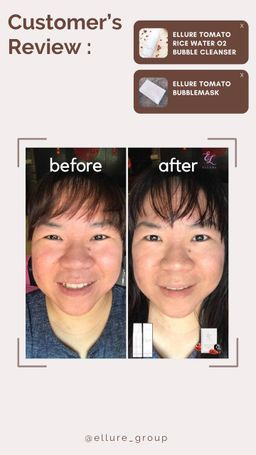 🔥𝐇𝐈𝐆𝐇𝐋𝐘 𝐑𝐀𝐕𝐄𝐃!!🔥 🍅𝐄𝐋𝐋𝐔𝐑𝐄 𝐓𝐎𝐌𝐀𝐓𝐎 𝐃𝐄𝐄𝐏 𝐂𝐋𝐄𝐀𝐍𝐒𝐈𝐍𝐆 𝐆𝐑𝐀𝐏𝐇𝐄𝐍𝐄 𝐁𝐔𝐁𝐁𝐋𝐄 𝐌𝐀𝐒𝐊🍅 - EXFOLIATING MASK