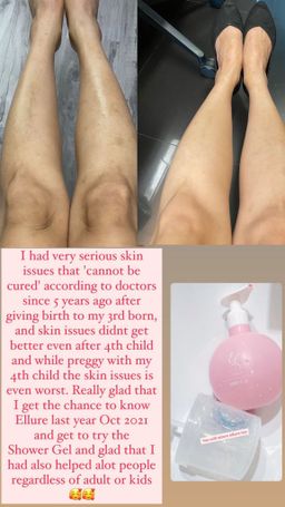 🍅𝐈𝐍𝐒𝐓𝐎𝐂𝐊🍅 𝐄𝐋𝐋𝐔𝐑𝐄 𝐓𝐎𝐌𝐀𝐓𝐎 𝐈𝐍𝐕𝐈𝐆𝐎𝐑𝐀𝐓𝐈𝐍𝐆 𝐒𝐇𝐎𝐖𝐄𝐑 𝐆𝐄𝐋| Skin Problems | Eczema | Back Acne | Sweat Prone Skin | Dry Skin