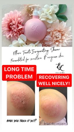 🍅𝐈𝐍𝐒𝐓𝐎𝐂𝐊🍅 𝐄𝐋𝐋𝐔𝐑𝐄 𝐓𝐎𝐌𝐀𝐓𝐎 𝐈𝐍𝐕𝐈𝐆𝐎𝐑𝐀𝐓𝐈𝐍𝐆 𝐒𝐇𝐎𝐖𝐄𝐑 𝐆𝐄𝐋| Skin Problems | Eczema | Back Acne | Sweat Prone Skin | Dry Skin