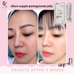 🇰🇷𝐌𝐀𝐃𝐄 𝐈𝐍 𝐊𝐎𝐑𝐄𝐀!🇰🇷 𝐄𝐋𝐋𝐔𝐑𝐄 𝟭𝟬-𝗜𝗡-𝟭 𝗥𝗘𝗗 𝗚𝗜𝗡𝗦𝗘𝗡𝗚 𝗦𝗞𝗜𝗡 𝗕𝗢𝗢𝗦𝗧𝗘𝗥 𝗝𝗘𝗟𝗟𝗬 | 𝐒𝐔𝐏-𝐈𝐓 𝐅𝐑𝐎𝐌 𝐊𝐎𝐑𝐄𝐀! SKIN SUPPLEMENT