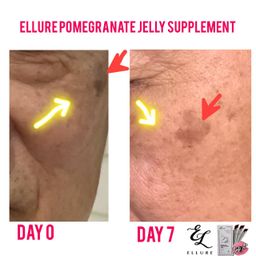 🇰🇷𝐌𝐀𝐃𝐄 𝐈𝐍 𝐊𝐎𝐑𝐄𝐀!🇰🇷 𝐄𝐋𝐋𝐔𝐑𝐄 𝟭𝟬-𝗜𝗡-𝟭 𝗥𝗘𝗗 𝗚𝗜𝗡𝗦𝗘𝗡𝗚 𝗦𝗞𝗜𝗡 𝗕𝗢𝗢𝗦𝗧𝗘𝗥 𝗝𝗘𝗟𝗟𝗬 | 𝐒𝐔𝐏-𝐈𝐓 𝐅𝐑𝐎𝐌 𝐊𝐎𝐑𝐄𝐀! SKIN SUPPLEMENT