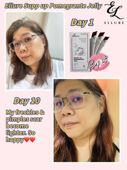 🇰🇷𝐌𝐀𝐃𝐄 𝐈𝐍 𝐊𝐎𝐑𝐄𝐀!🇰🇷 𝐄𝐋𝐋𝐔𝐑𝐄 𝟭𝟬-𝗜𝗡-𝟭 𝗥𝗘𝗗 𝗚𝗜𝗡𝗦𝗘𝗡𝗚 𝗦𝗞𝗜𝗡 𝗕𝗢𝗢𝗦𝗧𝗘𝗥 𝗝𝗘𝗟𝗟𝗬 | 𝐒𝐔𝐏-𝐈𝐓 𝐅𝐑𝐎𝐌 𝐊𝐎𝐑𝐄𝐀! SKIN SUPPLEMENT