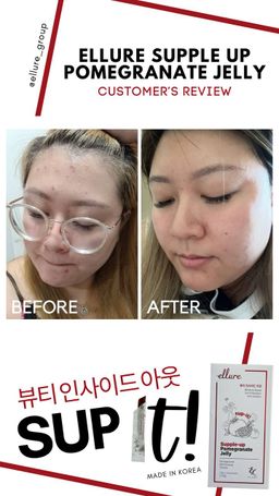 🇰🇷𝐌𝐀𝐃𝐄 𝐈𝐍 𝐊𝐎𝐑𝐄𝐀!🇰🇷 𝐄𝐋𝐋𝐔𝐑𝐄 𝟭𝟬-𝗜𝗡-𝟭 𝗥𝗘𝗗 𝗚𝗜𝗡𝗦𝗘𝗡𝗚 𝗦𝗞𝗜𝗡 𝗕𝗢𝗢𝗦𝗧𝗘𝗥 𝗝𝗘𝗟𝗟𝗬 | 𝐒𝐔𝐏-𝐈𝐓 𝐅𝐑𝐎𝐌 𝐊𝐎𝐑𝐄𝐀! SKIN SUPPLEMENT